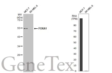 Anti-FOXA1 antibody [HL1975] used in Western Blot (WB). GTX637868