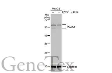 Anti-FOXA1 antibody [HL1975] used in Western Blot (WB). GTX637868