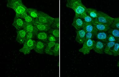 Anti-ELAVL2 antibody [HL1978] used in Immunocytochemistry/ Immunofluorescence (ICC/IF). GTX637871