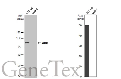 Anti-AHR antibody [HL1983] used in Western Blot (WB). GTX637884