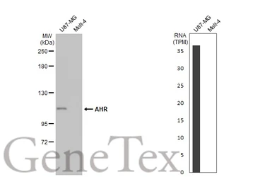 Anti-AHR antibody [HL1984] used in Western Blot (WB). GTX637885