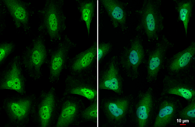 Anti-AHR antibody [HL1984] used in Immunocytochemistry/ Immunofluorescence (ICC/IF). GTX637885