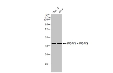 Anti-WDFY1 + WDFY2 antibody [HL1989] used in Western Blot (WB). GTX637890