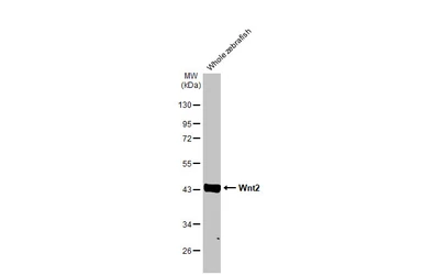 Anti-Wnt2 antibody [HL1999] used in Western Blot (WB). GTX637900