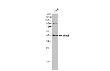 Anti-Wnt2 antibody [HL1999] used in Western Blot (WB). GTX637900
