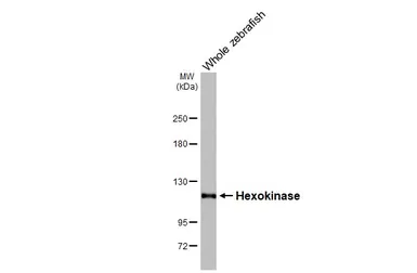 Anti-Hexokinase antibody [HL2000] used in Western Blot (WB). GTX637901