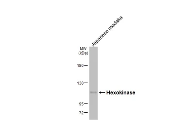 Anti-Hexokinase antibody [HL2000] used in Western Blot (WB). GTX637901