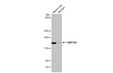 Anti-ORP150 antibody [HL2006] used in Western Blot (WB). GTX637907