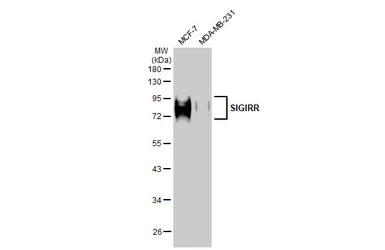 Anti-SIGIRR antibody [HL2007] used in Western Blot (WB). GTX637908