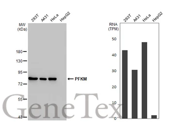 Anti-PFKM antibody [HL2010] used in Western Blot (WB). GTX637911