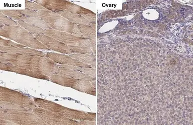 Anti-PFKM antibody [HL2010] used in IHC (Paraffin sections) (IHC-P). GTX637911