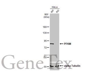 Anti-PFKM antibody [HL2010] used in Western Blot (WB). GTX637911