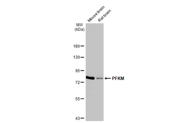 Anti-PFKM antibody [HL2010] used in Western Blot (WB). GTX637911