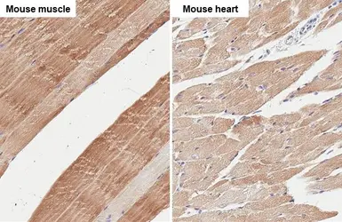 Anti-PFKM antibody [HL2010] used in IHC (Paraffin sections) (IHC-P). GTX637911