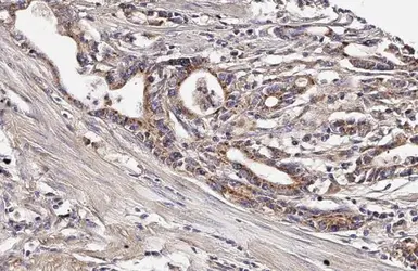 Anti-mtTFA antibody [HL2012] used in IHC (Paraffin sections) (IHC-P). GTX637913