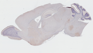 Anti-Choline Acetyltransferase antibody [HL2014] used in IHC (Paraffin sections) (IHC-P). GTX637915