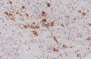 Anti-Choline Acetyltransferase antibody [HL2014] used in IHC (Paraffin sections) (IHC-P). GTX637915