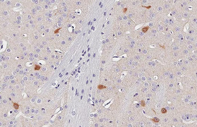 Anti-Choline Acetyltransferase antibody [HL2014] used in IHC (Paraffin sections) (IHC-P). GTX637915