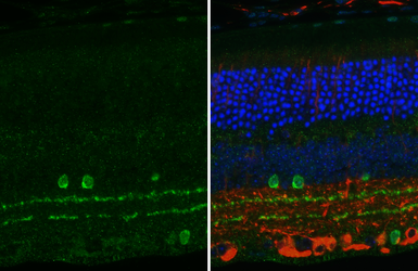 Anti-Choline Acetyltransferase antibody [HL2014] used in IHC (Paraffin sections) (IHC-P). GTX637915