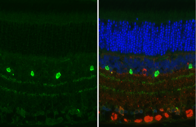Anti-Choline Acetyltransferase antibody [HL2014] used in IHC (Paraffin sections) (IHC-P). GTX637915