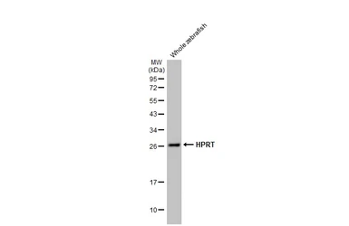 Anti-HPRT antibody [HL2015] used in Western Blot (WB). GTX637916