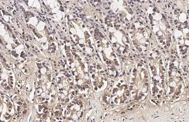Anti-HPRT antibody [HL2015] used in IHC (Paraffin sections) (IHC-P). GTX637916
