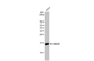 Anti-ISG15 antibody [HL2017] used in Western Blot (WB). GTX637918