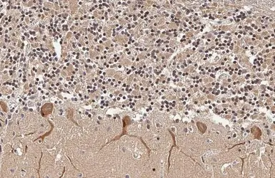 Anti-ISG15 antibody [HL2017] used in IHC (Paraffin sections) (IHC-P). GTX637918