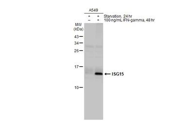 Anti-ISG15 antibody [HL2017] used in Western Blot (WB). GTX637918