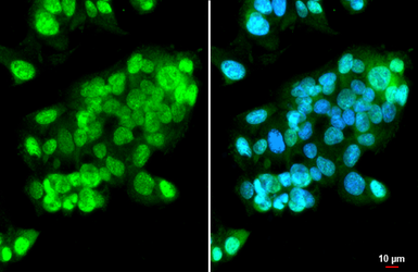 Anti-ISG15 antibody [HL2017] used in Immunocytochemistry/ Immunofluorescence (ICC/IF). GTX637918