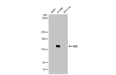 Anti-AXL antibody [HL2021] used in Western Blot (WB). GTX637922