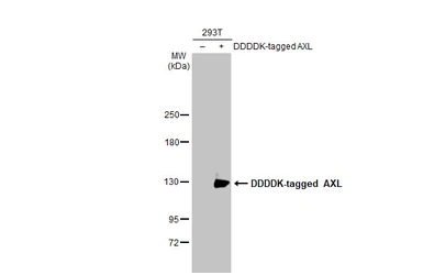 Anti-AXL antibody [HL2021] used in Western Blot (WB). GTX637922