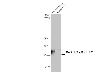 Anti-Mucin 4 antibody [HL2026] used in Western Blot (WB). GTX637927