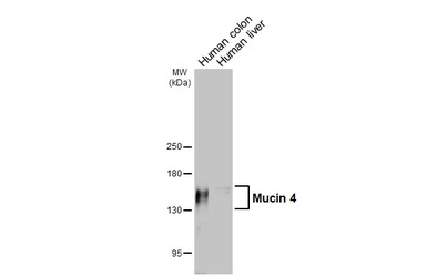 Anti-Mucin 4 antibody [HL2026] used in Western Blot (WB). GTX637927