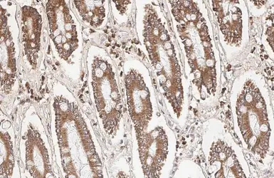 Anti-Bcl-XL antibody [HL2038] used in IHC (Paraffin sections) (IHC-P). GTX637939