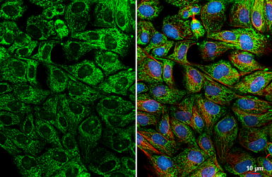 Anti-Bcl-XL antibody [HL2038] used in Immunocytochemistry/ Immunofluorescence (ICC/IF). GTX637939