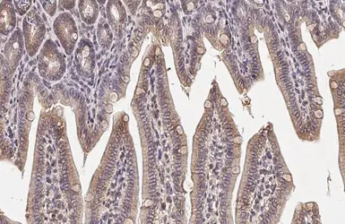 Anti-Bcl-XL antibody [HL2038] used in IHC (Paraffin sections) (IHC-P). GTX637939