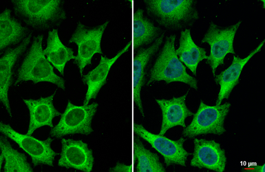 Anti-Bcl-XL antibody [HL2039] used in Immunocytochemistry/ Immunofluorescence (ICC/IF). GTX637940