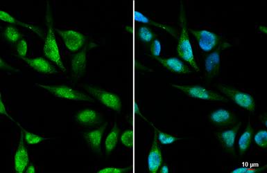 Anti-METTL1 antibody [HL2041] used in Immunocytochemistry/ Immunofluorescence (ICC/IF). GTX637942