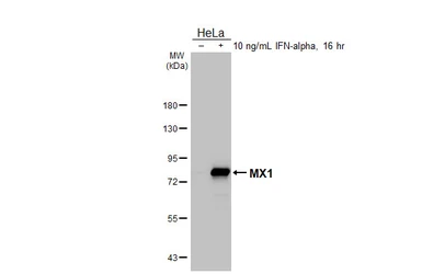 Anti-MX1 antibody [HL2051] used in Western Blot (WB). GTX637955