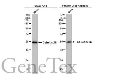 Anti-Calreticulin antibody [HL2057] used in Western Blot (WB). GTX637961