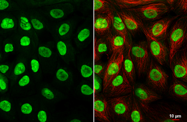 Anti-HMGB1 antibody [HL2059] used in Immunocytochemistry/ Immunofluorescence (ICC/IF). GTX637963