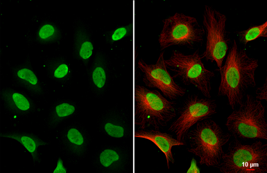 Anti-HMGB1 antibody [HL2059] used in Immunocytochemistry/ Immunofluorescence (ICC/IF). GTX637963