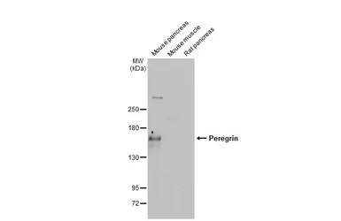 Anti-Peregrin antibody [HL2064] used in Western Blot (WB). GTX637968