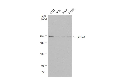 Anti-CHD2 antibody [HL2066] used in Western Blot (WB). GTX637970