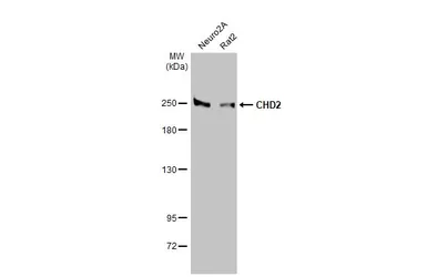 Anti-CHD2 antibody [HL2066] used in Western Blot (WB). GTX637970