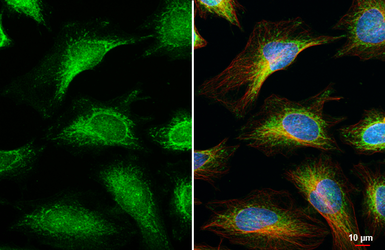 Anti-OGDH antibody [HL2072] used in Immunocytochemistry/ Immunofluorescence (ICC/IF). GTX637980