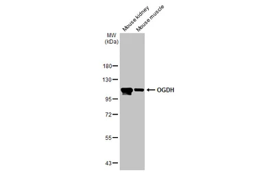 Anti-OGDH antibody [HL2072] used in Western Blot (WB). GTX637980