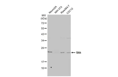 Anti-Shh antibody [HL2076] used in Western Blot (WB). GTX637984