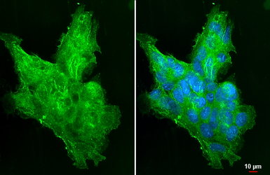 Anti-Shh antibody [HL2076] used in Immunocytochemistry/ Immunofluorescence (ICC/IF). GTX637984